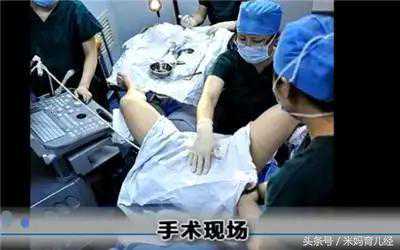 香港验血有不准备吗,试管婴儿全过程（图解），看哭了，真的心疼天下妈妈1