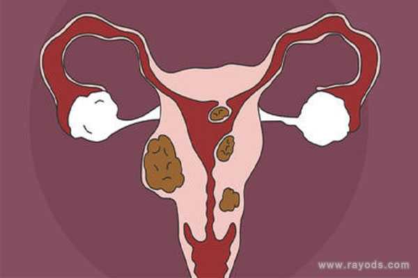 香港性别验血多少周,子宫肌瘤8cm做试管婴儿要注意哪些？