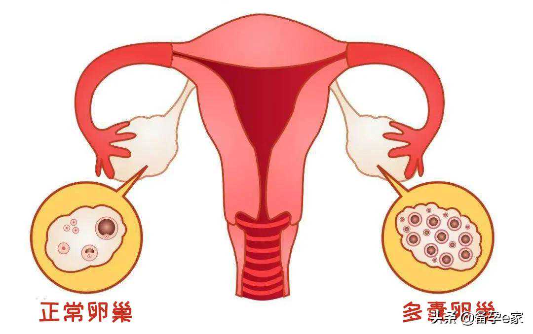 香港验血前同房会影响结果吗,备孕期间排卵试纸没测到强阳就转弱了能受孕吗