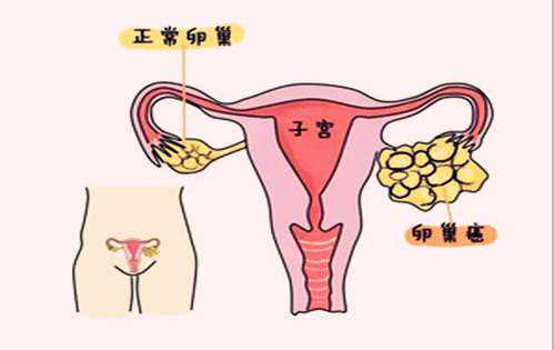 有多少孕妇香港验血的,不知不觉就怀不上了？附最全男女不孕不育排查方法