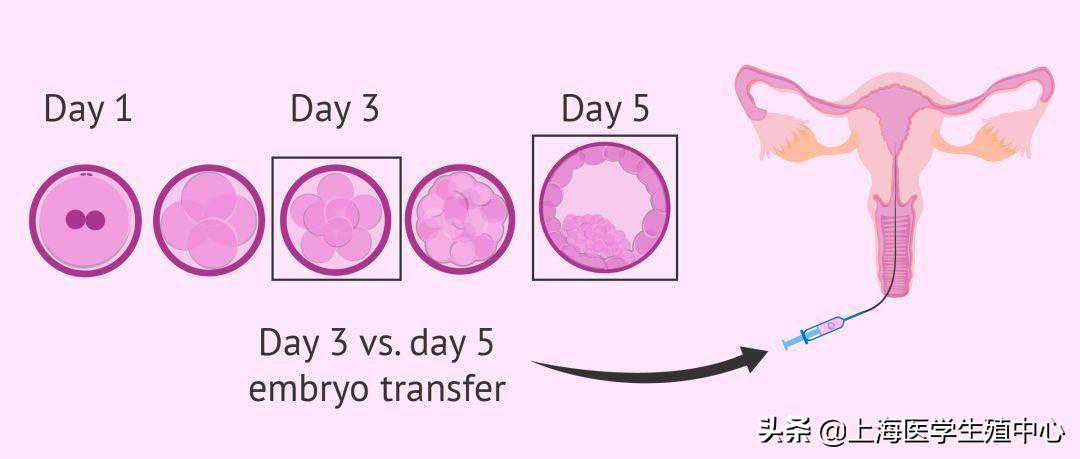 怀孕40天可以去香港验血查男女,试管婴儿冻胚VS鲜胚！如何移植更有利于怀孕？