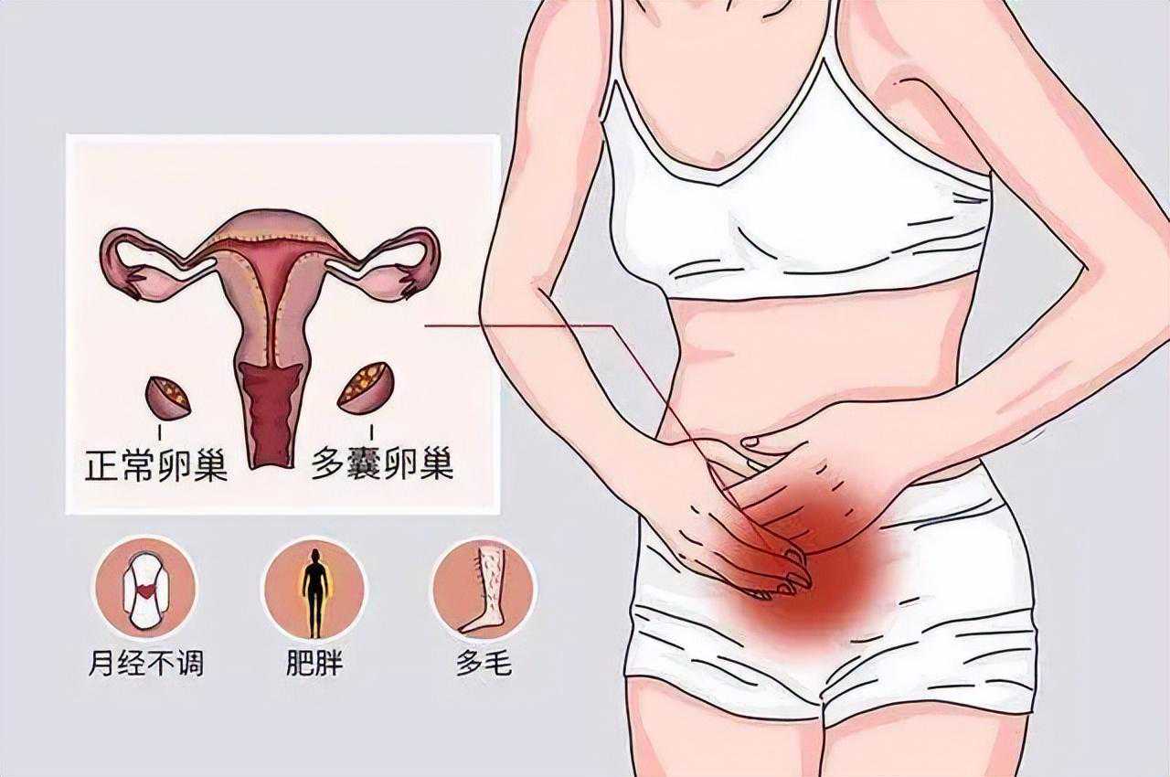 香港性别验血检查女孩检查报告,第三代试管婴儿的弊端与优势？(多囊卵巢直接