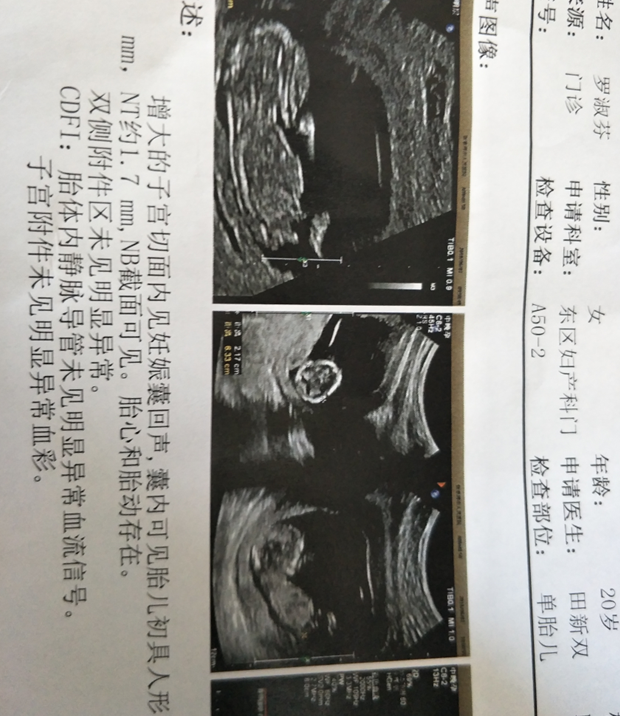 18周香港验血准确吗,正能量，大龄卵巢早衰，被判不孕，备孕半年，现已怀孕六