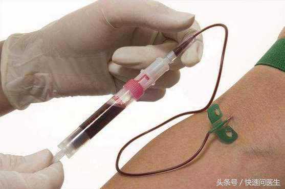 香港验血中介求推荐,不孕不育抽血化验之男性和女性的性激素六项检查正常值